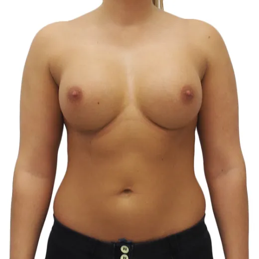 Image after