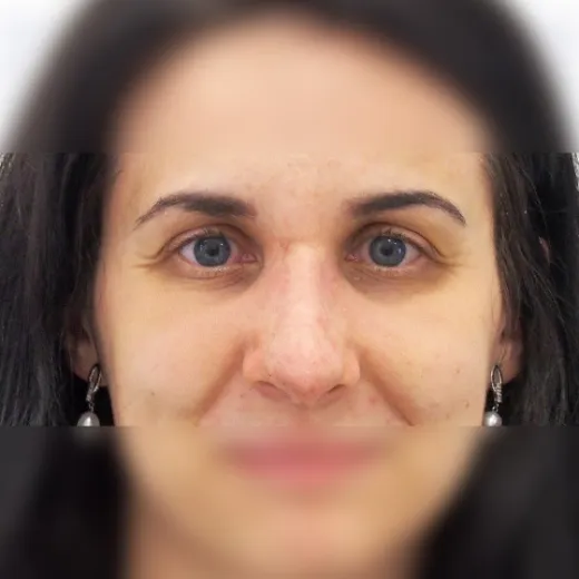 Image after