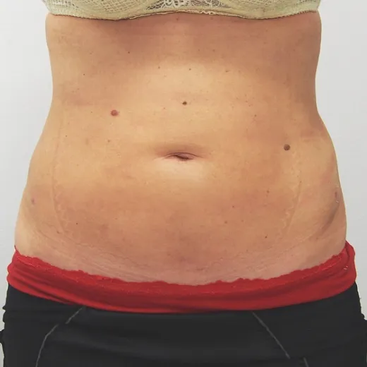 Image after