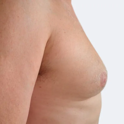 Image before