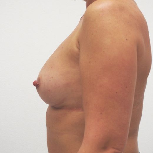 Image after